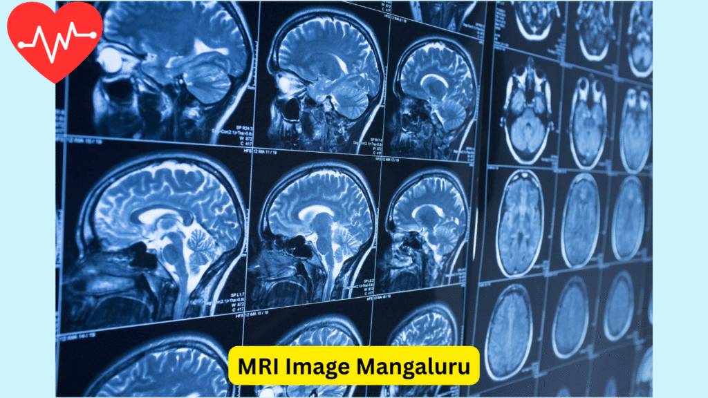 Brain MRI scan images displayed on a screen – Free MRI Scan in Mangaluru.